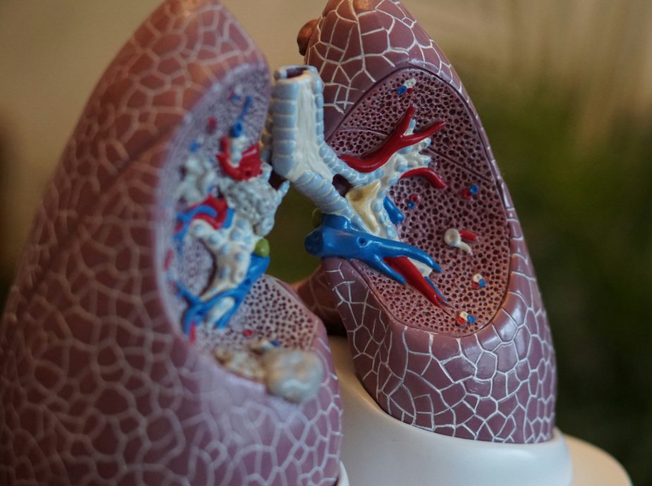 Obesity hypoventilation syndrome